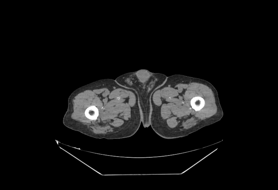 Corte axial CT real en el visor 2D de Circadis